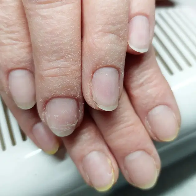 Dépose après 6 semaines de semi-permanent.