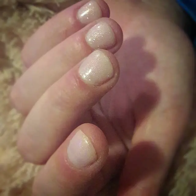 Elle rongé ses ongles il y a 3 semaines.