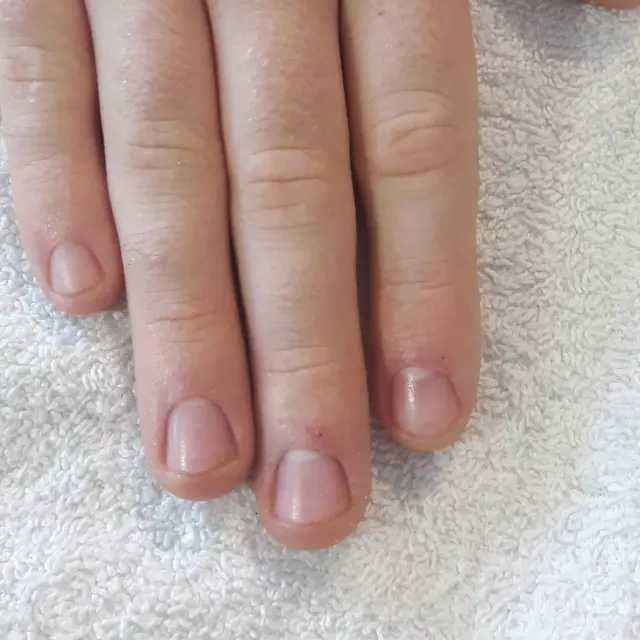 Manucure sur ongles rongés.