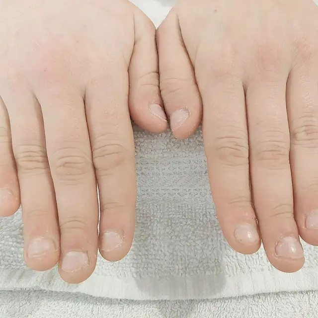 Swipe pour voir le résultat d'extentions sur ongles rongés