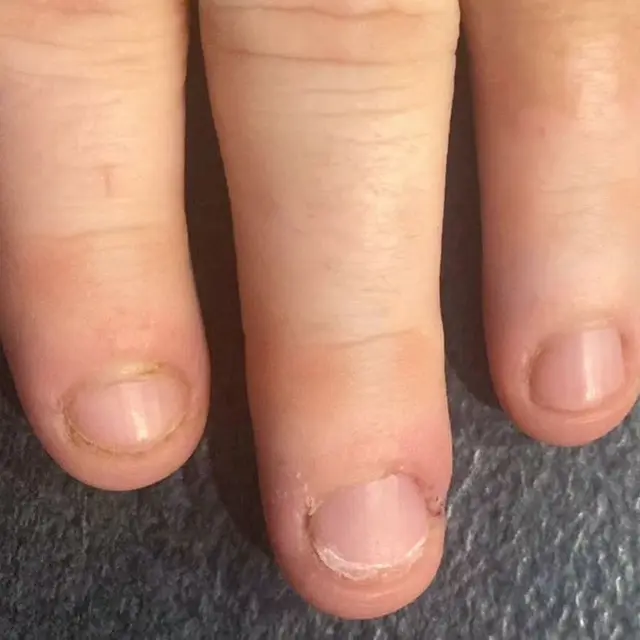 On partait de loins, après 1 mois, 1 semaine et 2 poses d'extensions, nous voila avec le semi-permanent sur ongles…