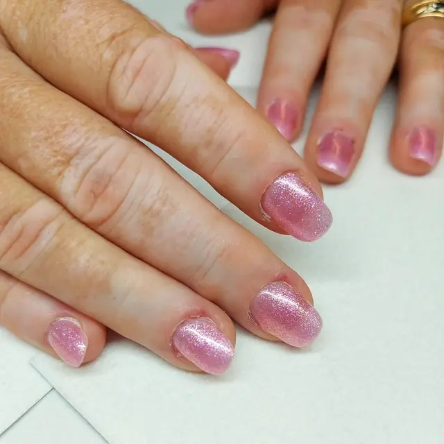 Extensions en acrygel sur ongles rongés.