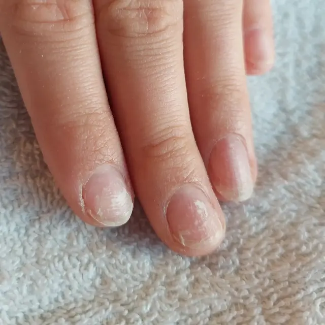 En plein apprenrissage d'extention en acrygel Voici ma 1ère pose vous en pensez quoi?